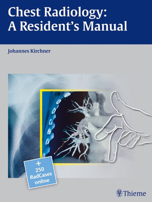 cover image of Chest Radiology